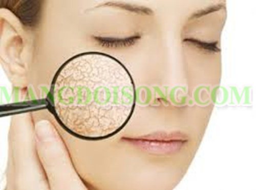 Da khô! Nguyên nhân và cách khắc phục