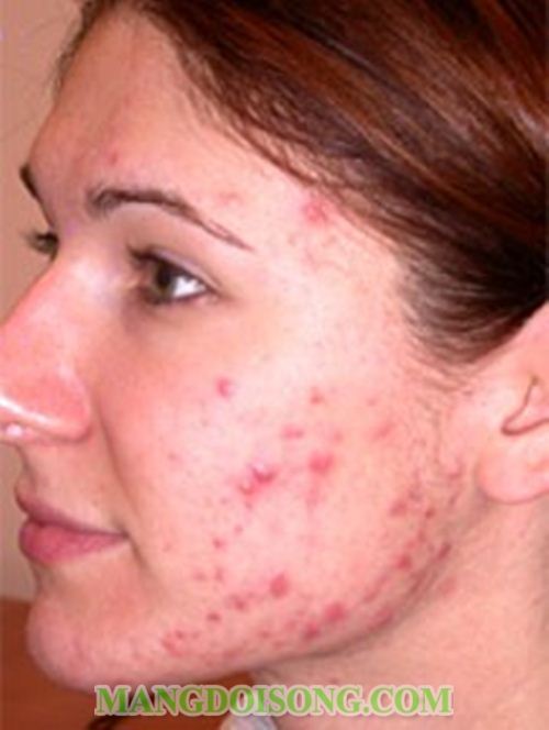 NHẬN BIẾT BỆNH QUA CÁC DẤU HIỆU TRÊN DA BẠN 2