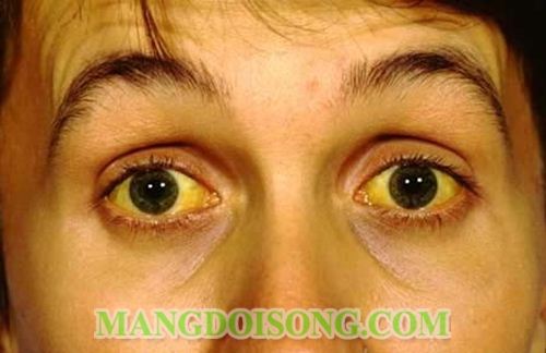 NHẬN BIẾT BỆNH QUA CÁC DẤU HIỆU TRÊN DA BẠN 3