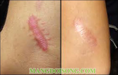 Baking soda là gì Baking soda mua ở đâu Tác dụng của baking soda 11